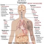 tramadol-side-effects-920.jpg