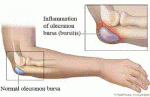 OLECRANON 1.GIF