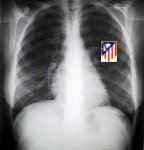 Radiografia+torax-2.JPG